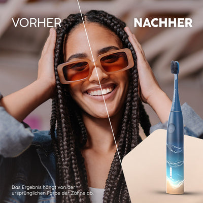 Brosse à dents sonique Eco Vibe 3